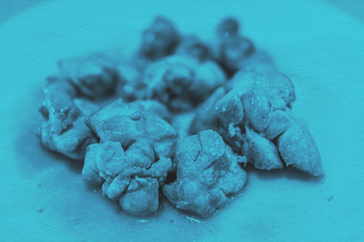 Closeup of cooked fried beef sweetbreads thymus organ gland